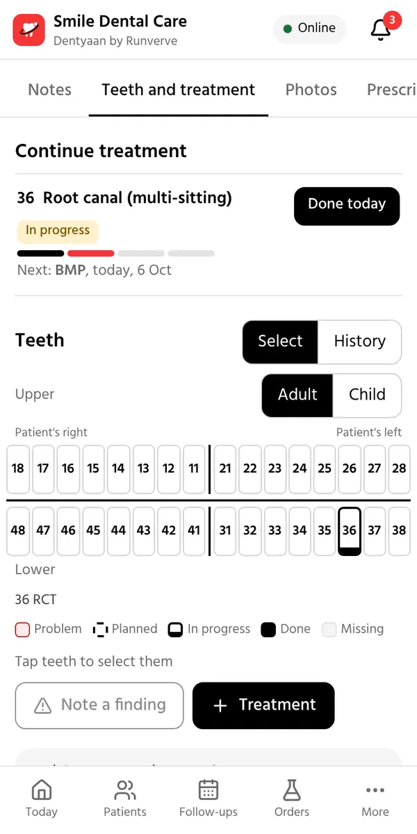 A patient's visit: the root canal on 36 is in progress, the next sitting is planned, and the tooth chart shows it.